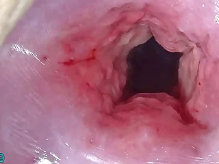 Uncensored Japanese Cervix Flourishing with the addition of Uterus Dilation with Penetration